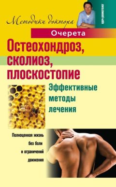 Александр Очерет - Остеохондроз, сколиоз, плоскостопие. Эффективные методы лечения