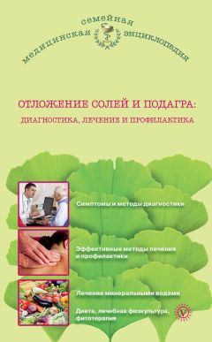 Екатерина Ольшанская - Отложение солей. Диагностика и правильное лечение