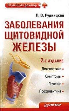 Леонид Рудницкий - Заболевания щитовидной железы: лечение и профилактика