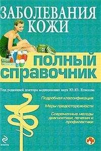 Светлана Чойжинимаева - Болезни нервных людей, или Откуда дует ветер?