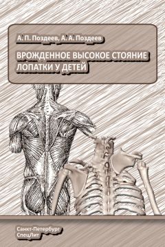 Андрей Поздеев - Врожденное высокое стояние лопатки у детей