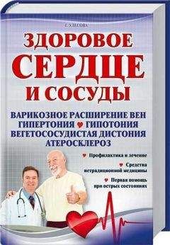 Юлия Попова - Заболевания сосудов. Самые эффективные методы лечения