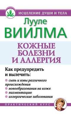 Ирина Пигулевская - Аллергия. Как ее победить. Простые и эффективные методы держать аллергию под контролем