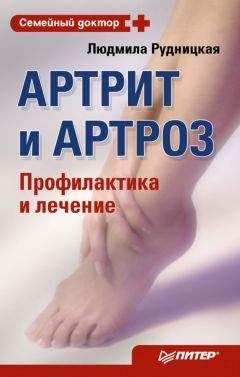 Людмила Рудницкая - Артрит и артроз. Карманный справочник