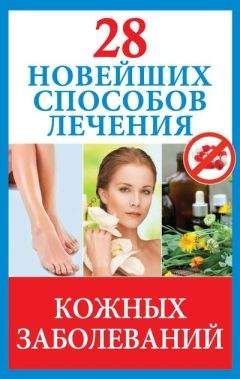 C. Мирошниченко - Грипп, ОРЗ: эффективная профилактика и лечение народными безлекарственными методами