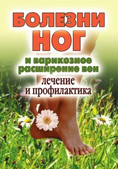 Дарья Нестерова - Болезни ног и варикозное расширение вен. Лечение и профилактика