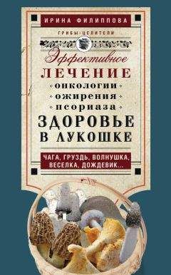 Елена Корсун - Псориаз. Старинные и современные методы лечения