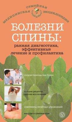 Коллектив Авторов - Заболевания позвоночника. Полный справочник