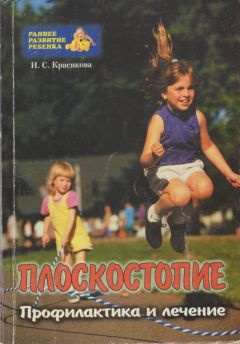 Ирина Красикова - Плоскостопие у детей
