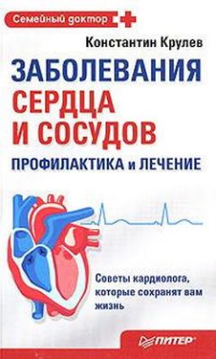Стивен Ниссен - Сердце. Справочник кардиопациента